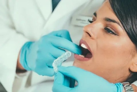 Can Teeth Whitening in Islamabad Improve Confidence and Self-Esteem?